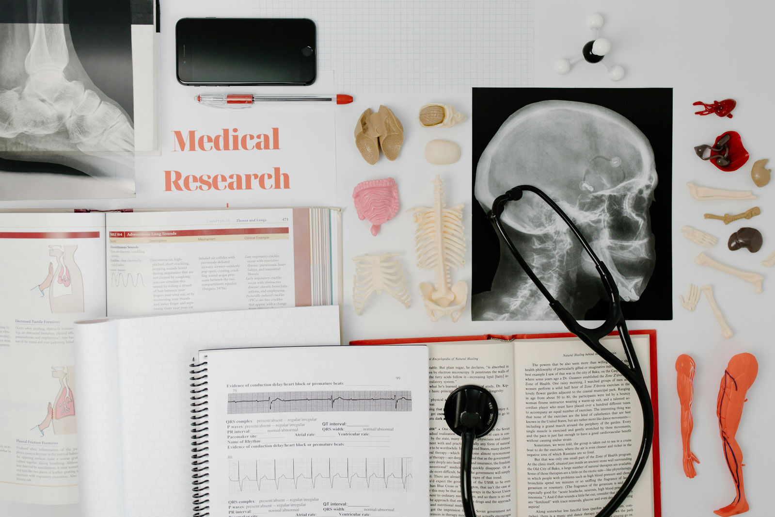 medical books, research, xrays, diagrams spread accors a desk. 
