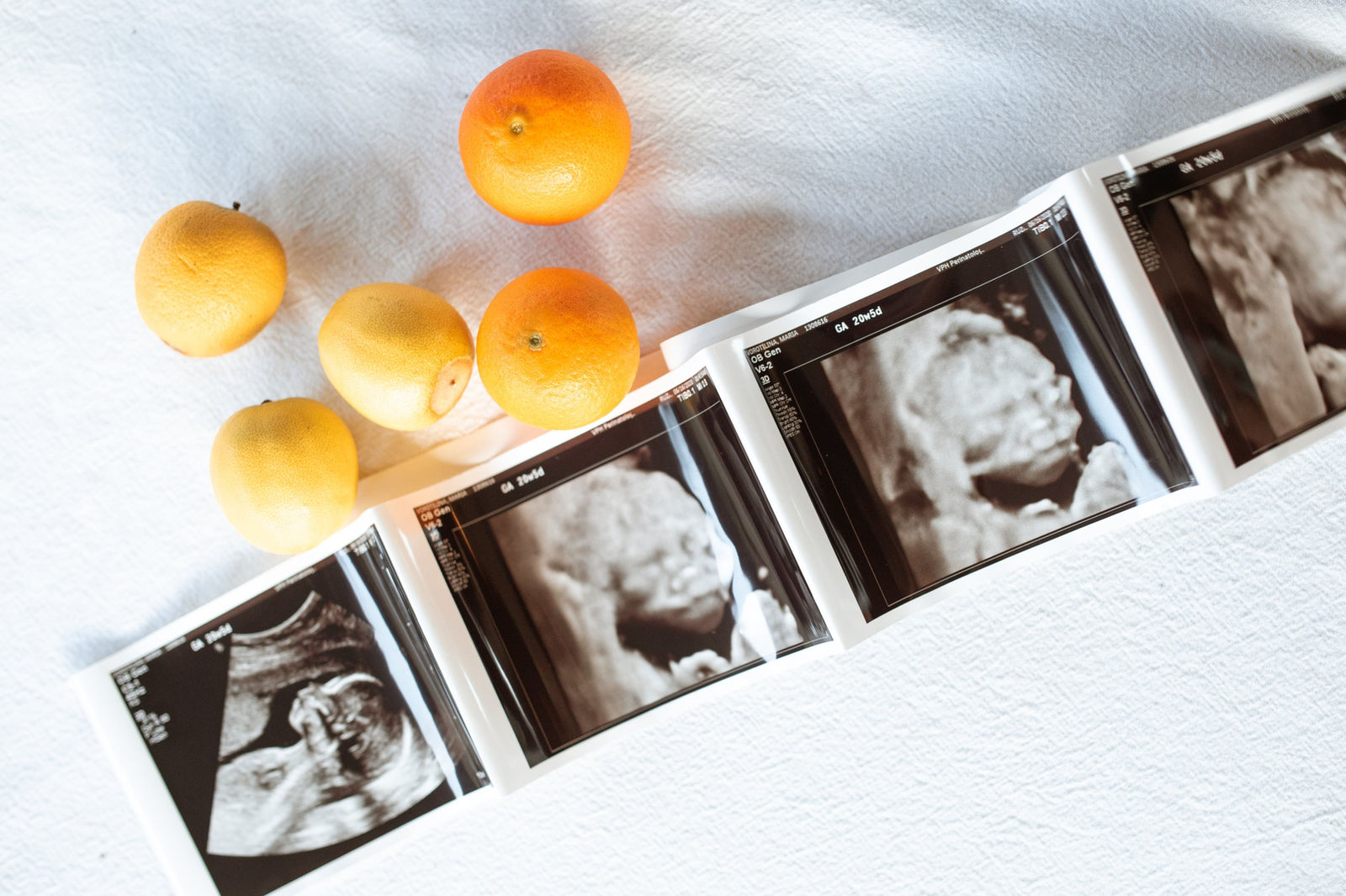 Nutrition, Exercise, and Stretches: Lifestyle Tips for Increasing Fertility