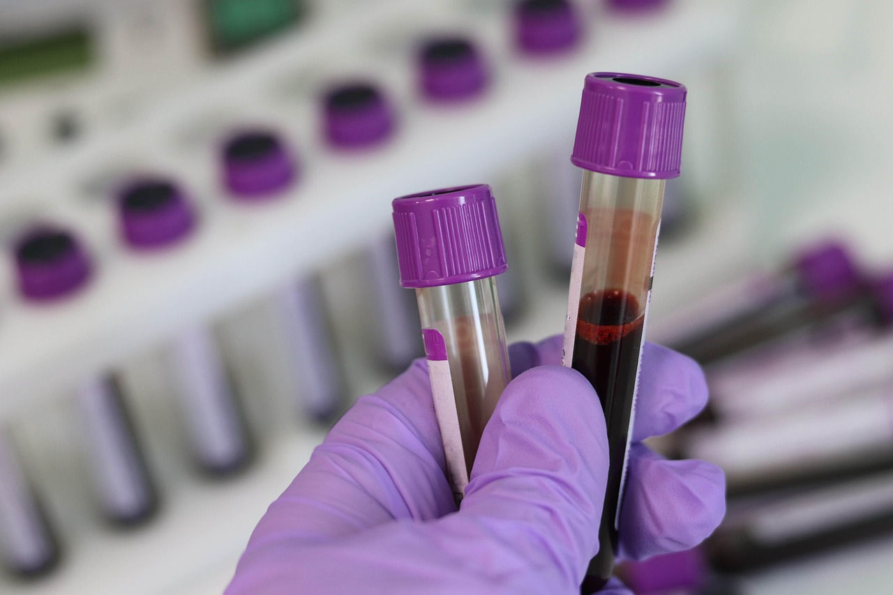 a hand wearing a rubber glove holding two lab vials of blood